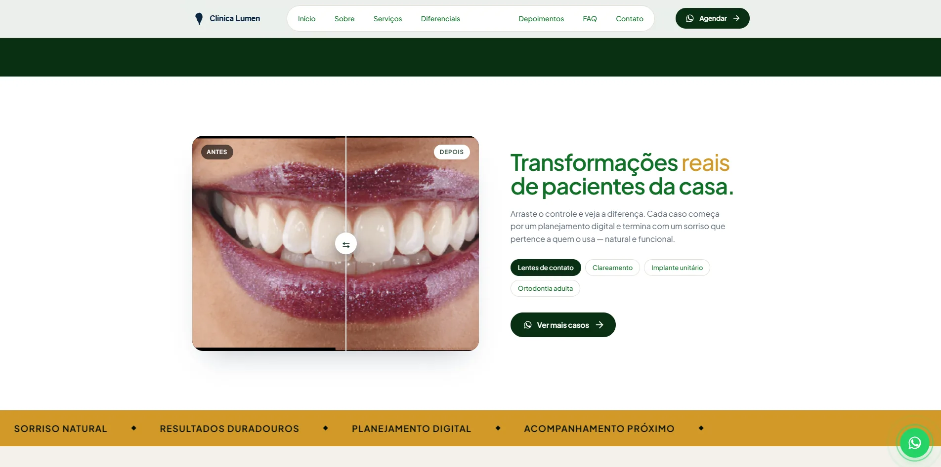 Slide de casos antes e depois do template de clínica odontológica